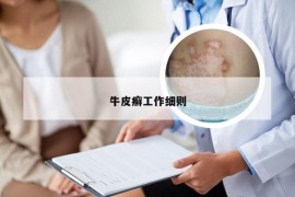 牛皮癣工作细则