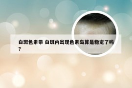 白斑色素带 白斑内出现色素岛算是稳定了吗?