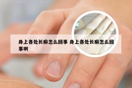 身上各处长癣怎么回事 身上各处长癣怎么回事啊