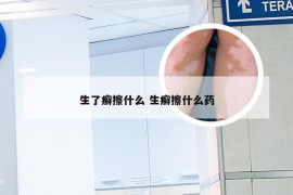 生了癣擦什么 生癣擦什么药