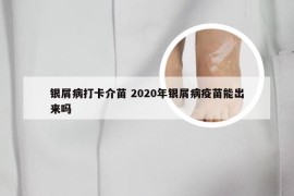 银屑病打卡介苗 2020年银屑病疫苗能出来吗