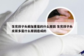 生完孩子头癣加重是的什么原因 生完孩子头皮屑多是什么原因造成的
