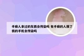 手癣人拿过的东西会传染吗 有手癣的人摸了我的手机会传染吗