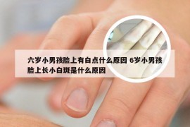 六岁小男孩脸上有白点什么原因 6岁小男孩脸上长小白斑是什么原因