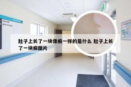 肚子上长了一块像癣一样的是什么 肚子上长了一块癣图片