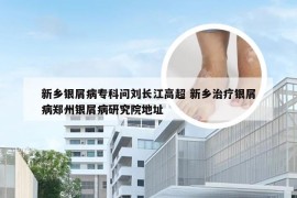 新乡银屑病专科问刘长江高超 新乡治疗银屑病郑州银屑病研究院地址