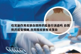 吃完副作用皮肤白斑停药能自行消退吗 白斑擦药后变模糊,但周围皮肤有点发白