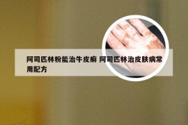 阿司匹林粉能治牛皮癣 阿司匹林治皮肤病常用配方