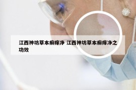 江西神坊草本癣痒净 江西神坊草本癣痒净之功效