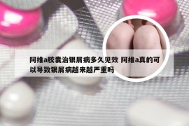 阿维a胶囊治银屑病多久见效 阿维a真的可以导致银屑病越来越严重吗
