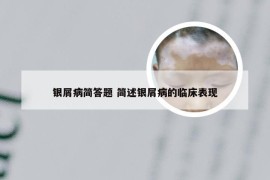 银屑病简答题 简述银屑病的临床表现