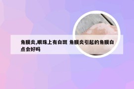 角膜炎,眼珠上有白斑 角膜炎引起的角膜白点会好吗
