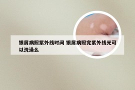 银屑病照紫外线时间 银屑病照完紫外线光可以洗澡么