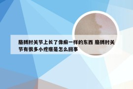 胳膊肘关节上长了像癣一样的东西 胳膊肘关节有很多小疙瘩是怎么回事