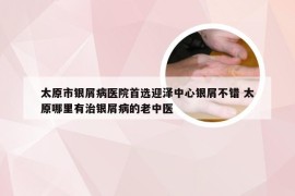 太原市银屑病医院首选迎泽中心银屑不错 太原哪里有治银屑病的老中医