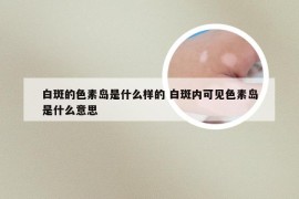 白斑的色素岛是什么样的 白斑内可见色素岛是什么意思