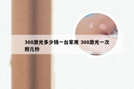 308激光多少钱一台家用 308激光一次照几秒
