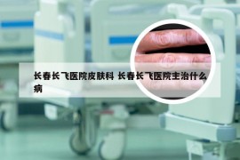 长春长飞医院皮肤科 长春长飞医院主治什么病