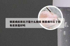 银屑病皮损无汗是什么原因 银屑病不红了但有皮损是好吗