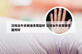 沈阳治牛皮癣道青菜超好 沈阳治牛皮屑哪家医院好