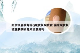 南京银屑病专科Q现代长城皮肤 南京现代长城皮肤病研究所消费高吗