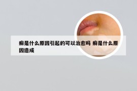 癣是什么原因引起的可以治愈吗 癣是什么原因造成