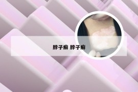 脖子癣 脖子癣