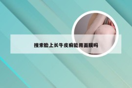 搜索脸上长牛皮癣能用面膜吗
