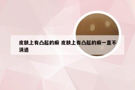 皮肤上有凸起的癣 皮肤上有凸起的癣一直不消退