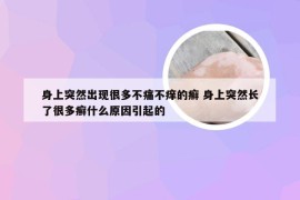 身上突然出现很多不痛不痒的癣 身上突然长了很多癣什么原因引起的