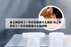 身上突然长了一片片的癣是什么原因 身上突然长了一片片的癣是什么原因呢