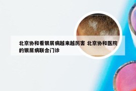北京协和看银屑病越来越厉害 北京协和医院的银屑病联合门诊