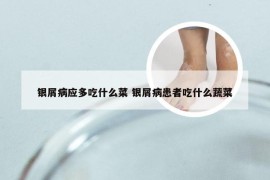 银屑病应多吃什么菜 银屑病患者吃什么蔬菜