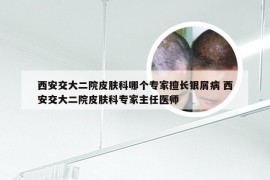 西安交大二院皮肤科哪个专家擅长银屑病 西安交大二院皮肤科专家主任医师