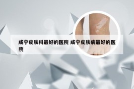 咸宁皮肤科最好的医院 咸宁皮肤病最好的医院
