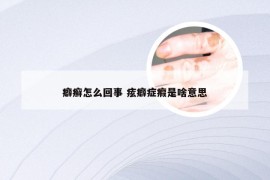 癖癣怎么回事 痃癖症瘕是啥意思