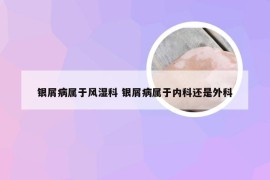 银屑病属于风湿科 银屑病属于内科还是外科