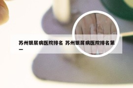 苏州银屑病医院排名 苏州银屑病医院排名第一