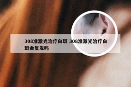 308准激光治疗白斑 308准激光治疗白斑会复发吗