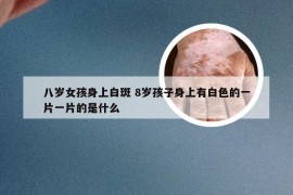 八岁女孩身上白斑 8岁孩子身上有白色的一片一片的是什么