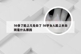 50多了脸上几处白了 50岁女人脸上长白斑是什么原因