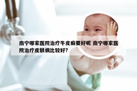 南宁哪家医院治疗牛皮癣要好呢 南宁哪家医院治疗皮肤病比较好?