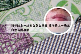 孩子脸上一块儿白怎么回事 孩子脸上一块儿白怎么回事啊
