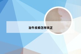 治牛皮癣怎样扶正
