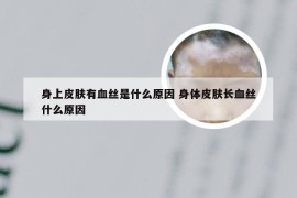 身上皮肤有血丝是什么原因 身体皮肤长血丝什么原因