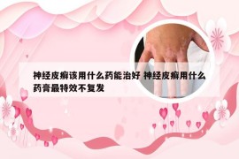 神经皮癣该用什么药能治好 神经皮癣用什么药膏最特效不复发