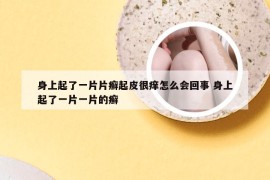 身上起了一片片癣起皮很痒怎么会回事 身上起了一片一片的癣