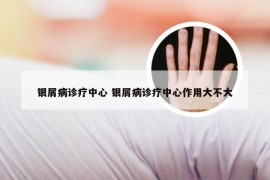 银屑病诊疗中心 银屑病诊疗中心作用大不大