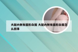 大腿内侧有圆形白圈 大腿内侧有圆形白圈怎么回事