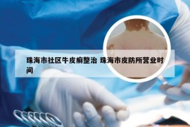 珠海市社区牛皮癣整治 珠海市皮防所营业时间